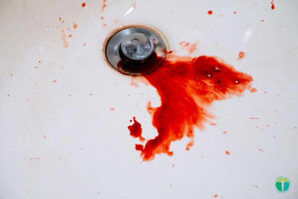 Рвота с кровью после алкоголя